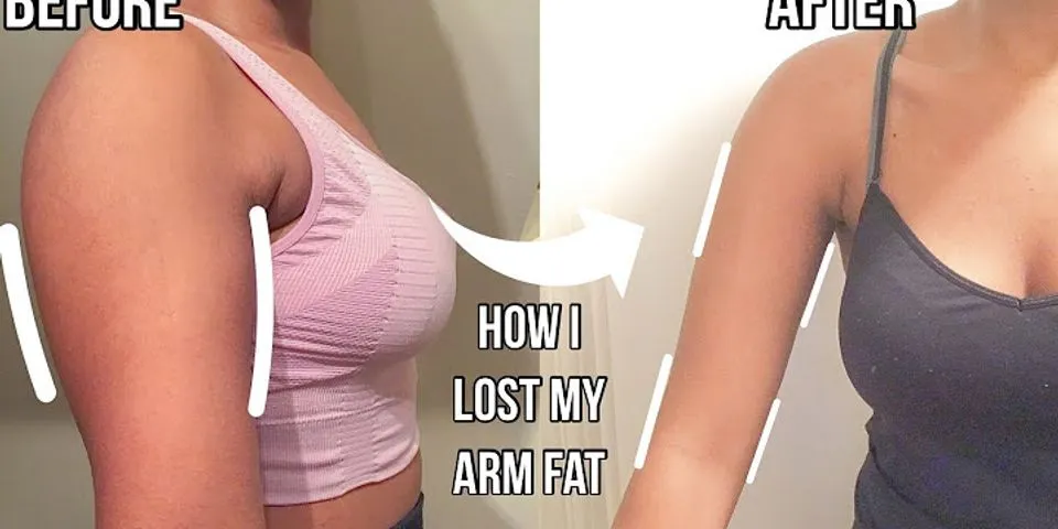How can I lose my arm fat in 2 weeks?